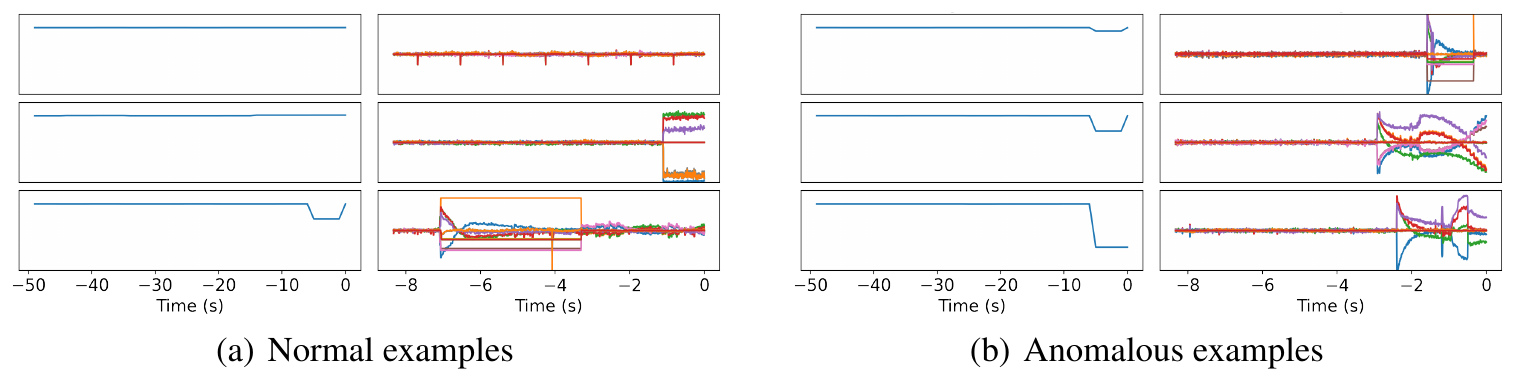 Six pairs of time-series panels from LCLS. Three pairs on the left are examples classified as normal, three on the right as anomalous. In each pair the left panel is the RF station signal over 50 seconds and the right panel is seven beam-position-monitor traces over 8 seconds; the anomalous pairs show a step in the RF signal followed by large excursions in the BPM traces.